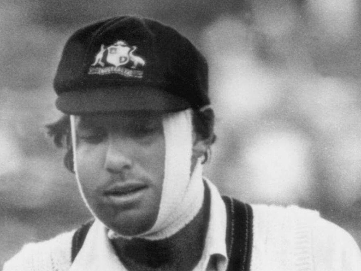 top-5-injured-test-match-players-who-refused-to-step-down A delivery from Bob Willis shattered Rick McCosker's jaw during the 1977 Centenary Test match against England. Despite having his jaw wired shut, he somehow came back in the second innings to assist Australia win a historic match by hitting crucial runs. (Image Credit: Newcastle Herald) - Photo Gallery
