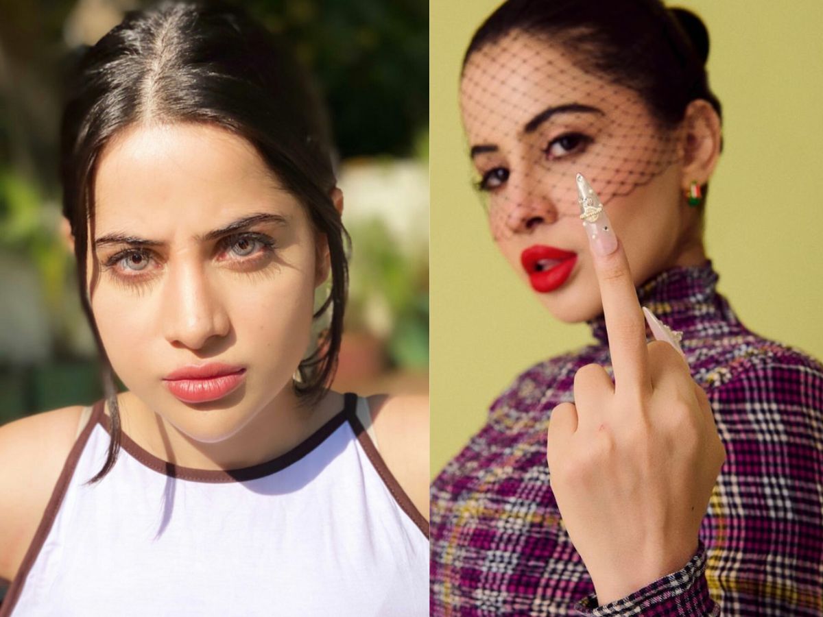 urfi-javed-lip-filler-gone-wrong-heres-the-full-story-from-under-eye-fillers-to-dissolution Urfi Javed Lip Filler Gone Wrong? Here’s The Full Story - Photo Gallery