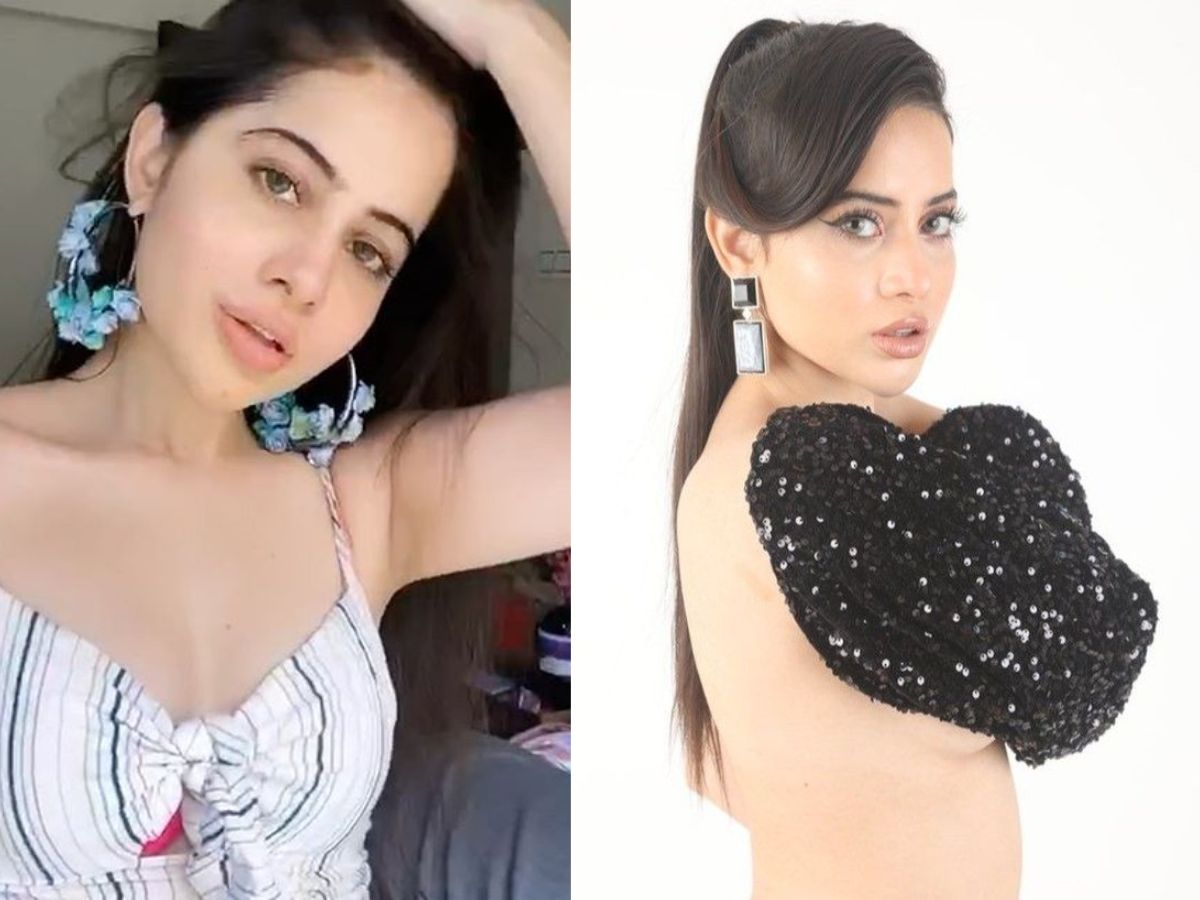urfi-javed-lip-filler-gone-wrong-heres-the-full-story-from-under-eye-fillers-to-dissolution Urfi Javed Lip Filler Gone Wrong? Here’s The Full Story - Photo Gallery
