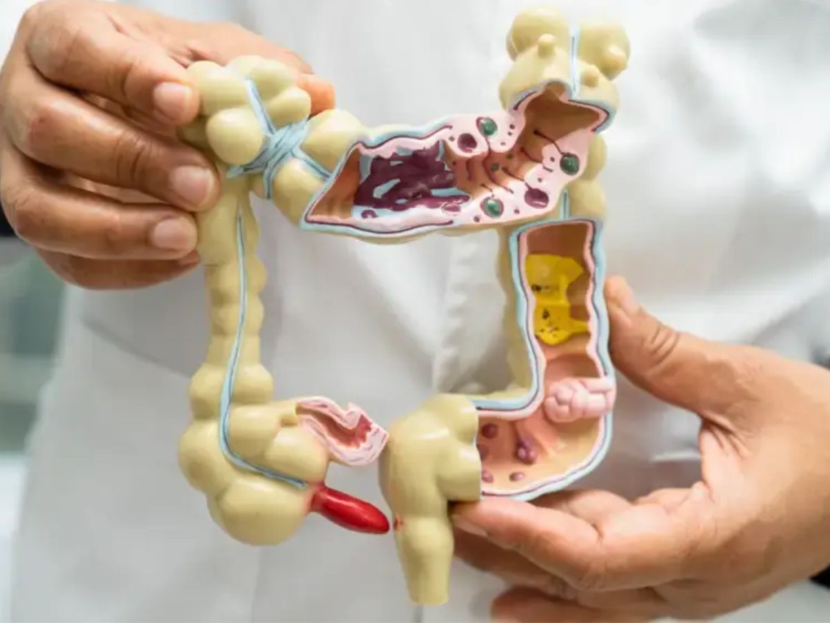 Top 6 Red Flags Of Gut Health You Should Not Ignore - Photo Gallery