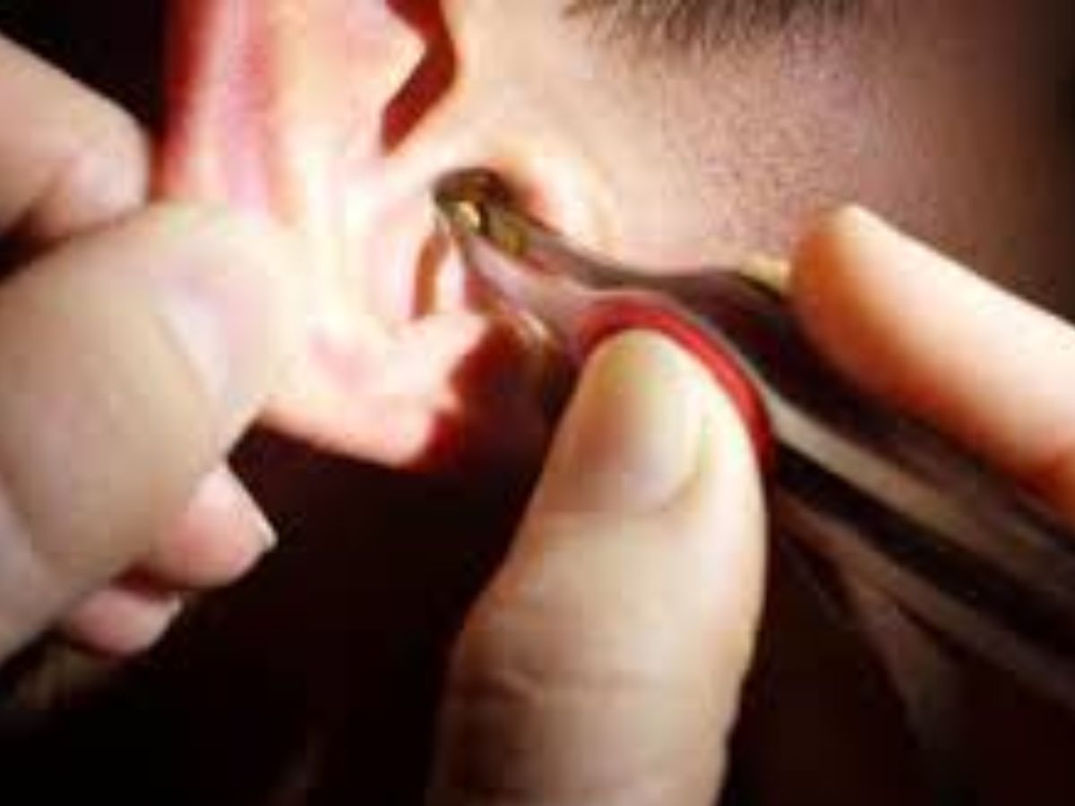 7-easy-and-affordable-methods-of-removing-earwax-in-a-right-way-without-harming-the-delicate-structure-of-the-ear Are you facing hearing problems?? Everything You Need To Know About Removing Earwax The Right Way - Photo Gallery