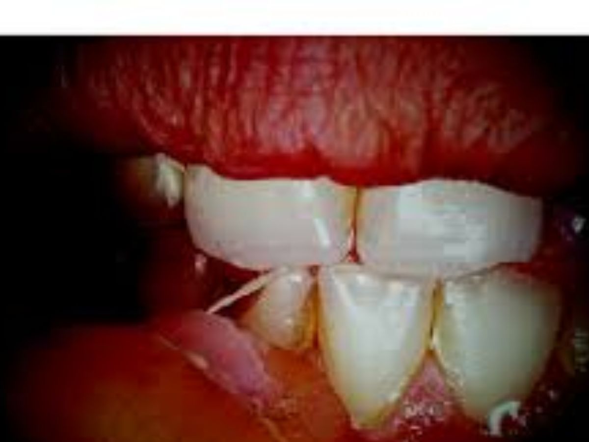 Secretly This Habit Is Harming Your Body!! 8 Health Problems Caused By Eating Nails - Photo Gallery