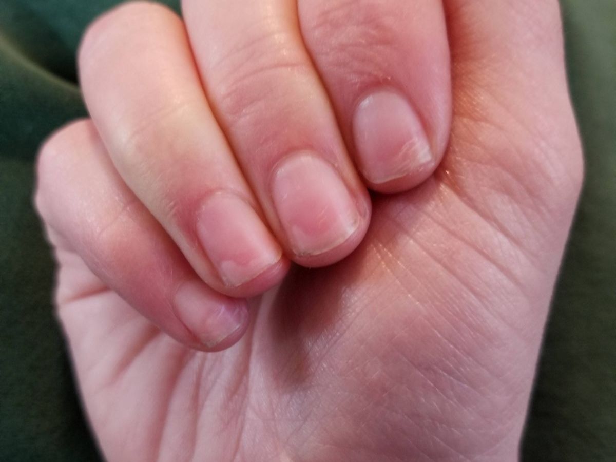 Secretly This Habit Is Harming Your Body!! 8 Health Problems Caused By Eating Nails - Photo Gallery