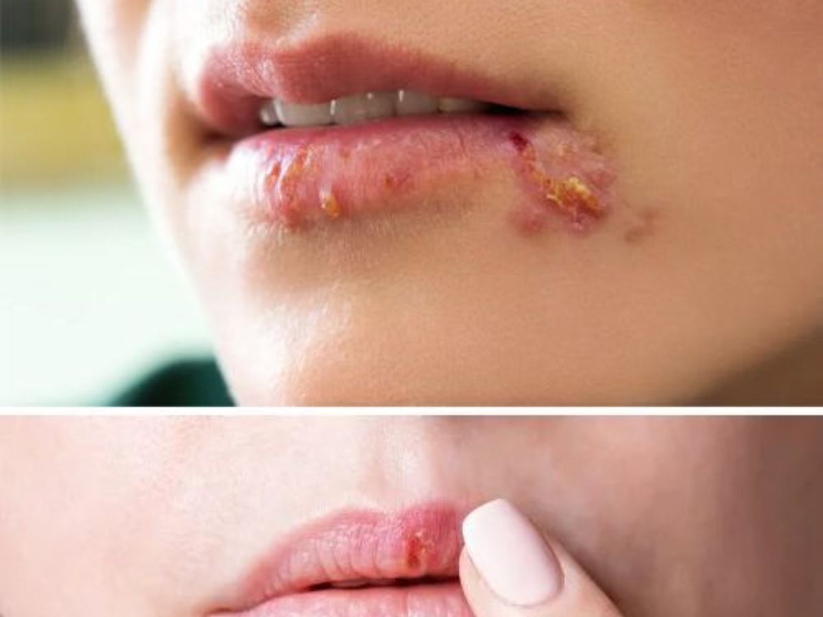 Secretly This Habit Is Harming Your Body!! 8 Health Problems Caused By Eating Nails - Photo Gallery