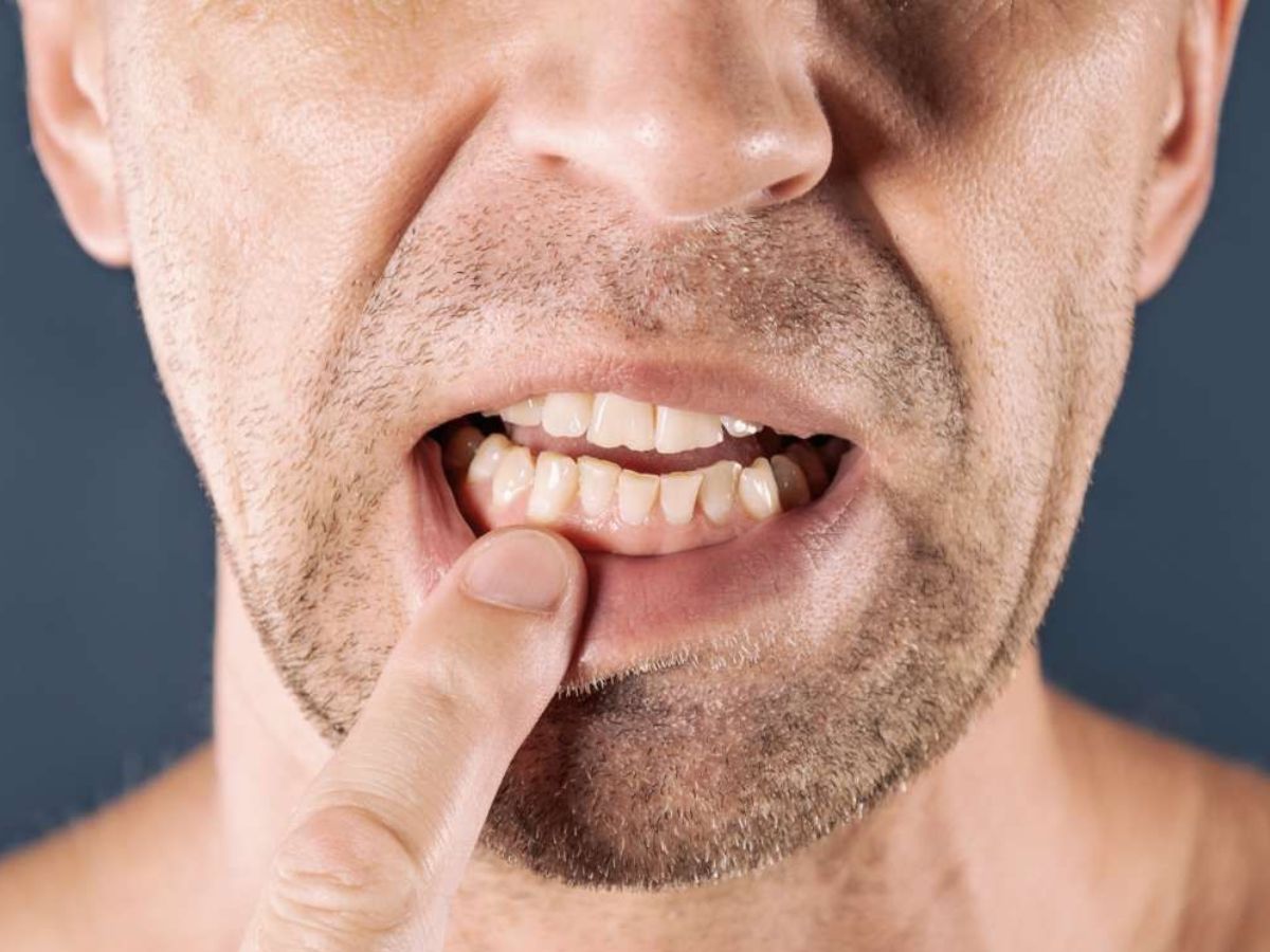 Secretly This Habit Is Harming Your Body!! 8 Health Problems Caused By Eating Nails - Photo Gallery