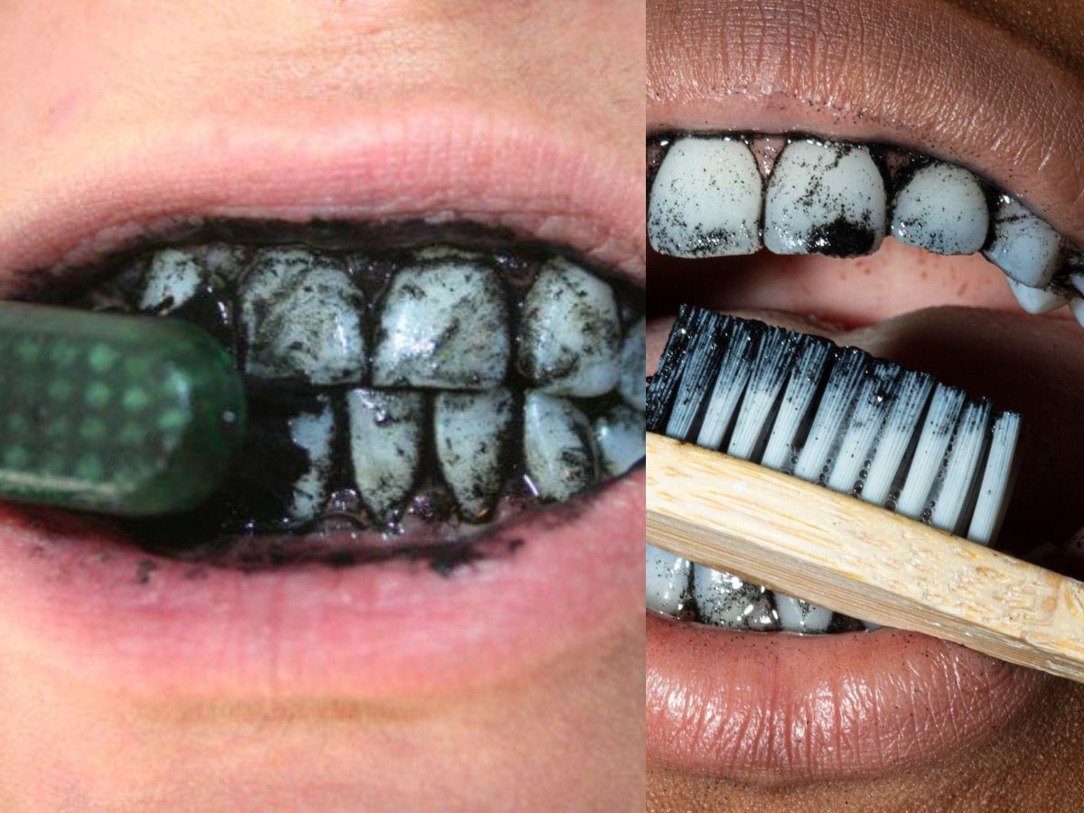 shine-your-yellow-teeth-with-these-traditional-methods-no-chemicals-just-smile-out-loud-with-brighter-teeth Want Teeth’s Whiter Brighter? Use These 7 Traditional Hacks To Glow Up Your Smile Naturally - Photo Gallery
