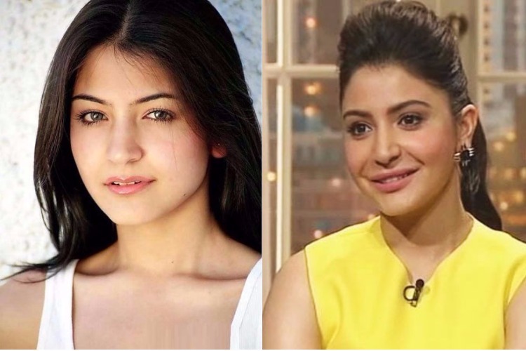 stars-who-changed-after-surgery-before-vs-after-pics Stars Who Changed After Surgery – Before vs After Pics. - Photo Gallery