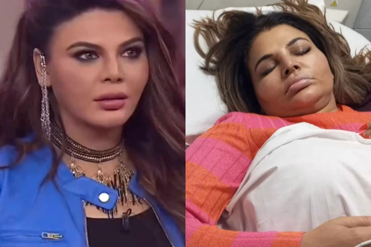 stars-who-changed-after-surgery-before-vs-after-pics Stars Who Changed After Surgery – Before vs After Pics. - Photo Gallery