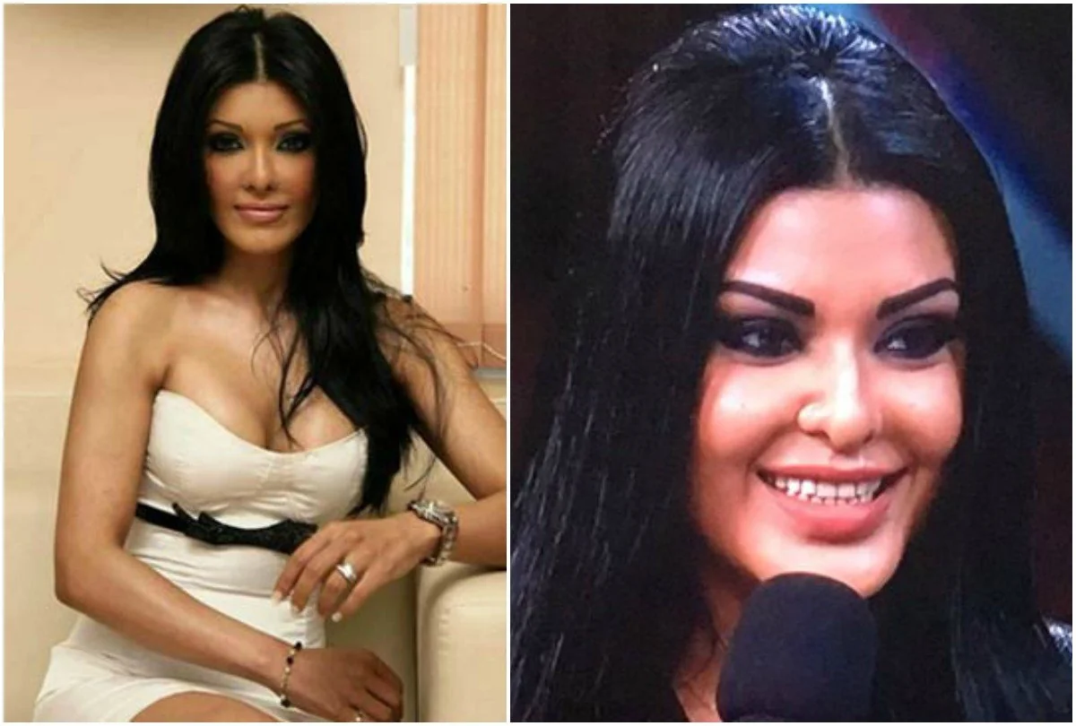 stars-who-changed-after-surgery-before-vs-after-pics Stars Who Changed After Surgery – Before vs After Pics. - Photo Gallery