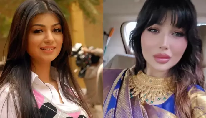 stars-who-changed-after-surgery-before-vs-after-pics Stars Who Changed After Surgery – Before vs After Pics. - Photo Gallery