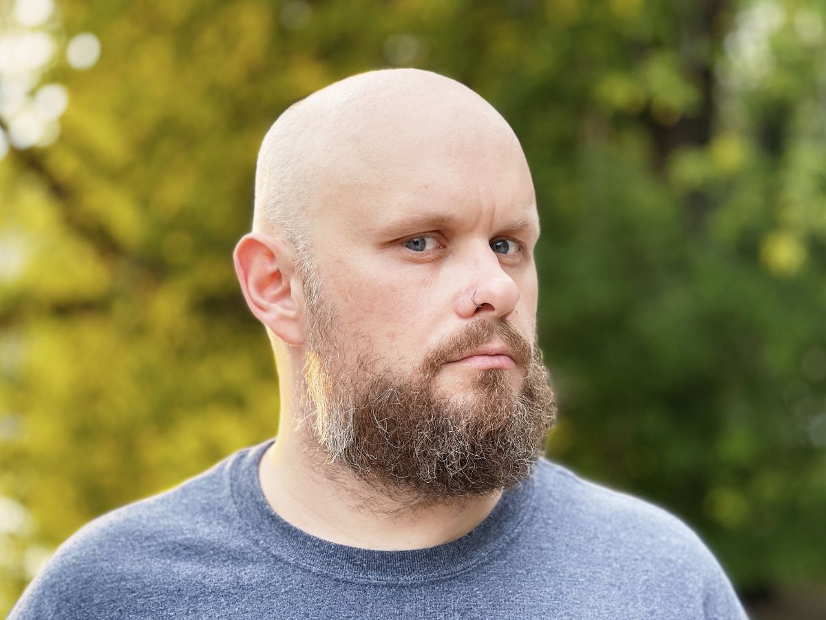 6-effective-ways-to-get-rid-of-beard-dandruff-naturally-and-permanently 6 Effective Ways to Get Rid of Beard Dandruff Naturally and Permanently - Photo Gallery