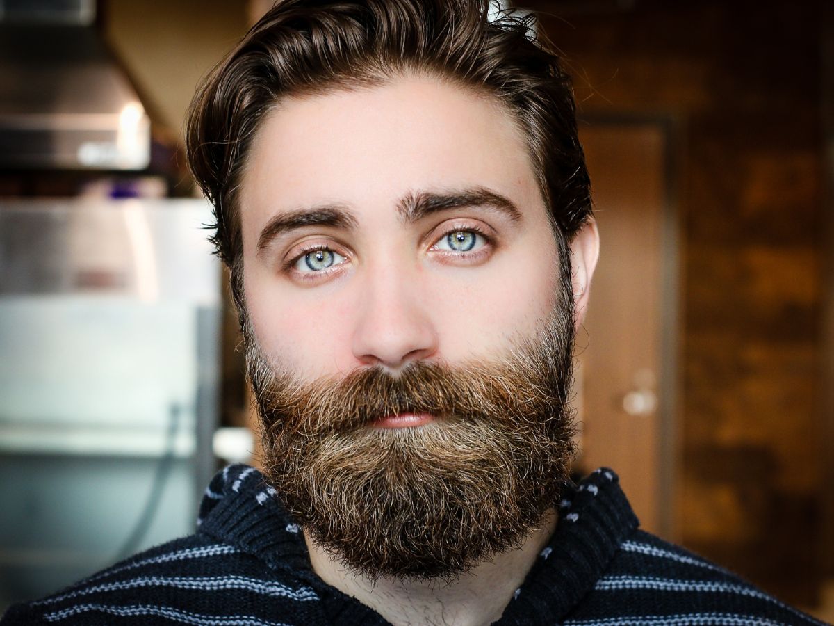 6-effective-ways-to-get-rid-of-beard-dandruff-naturally-and-permanently 6 Effective Ways to Get Rid of Beard Dandruff Naturally and Permanently - Photo Gallery