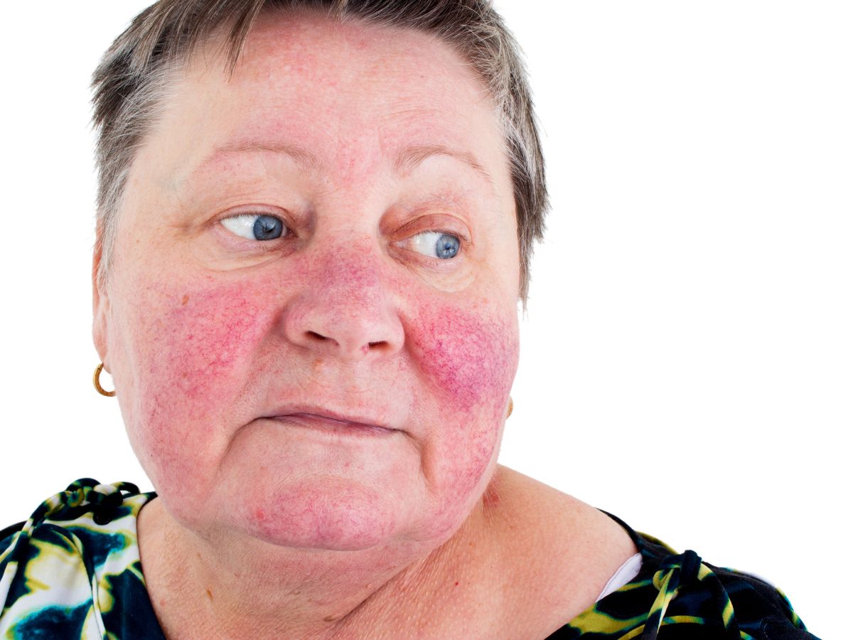 top-5-signs-you-are-over-exfoliating-your-skin-this-monsoon Top 5 Signs You Are Over-Exfoliating Your Skin This Monsoon - Photo Gallery