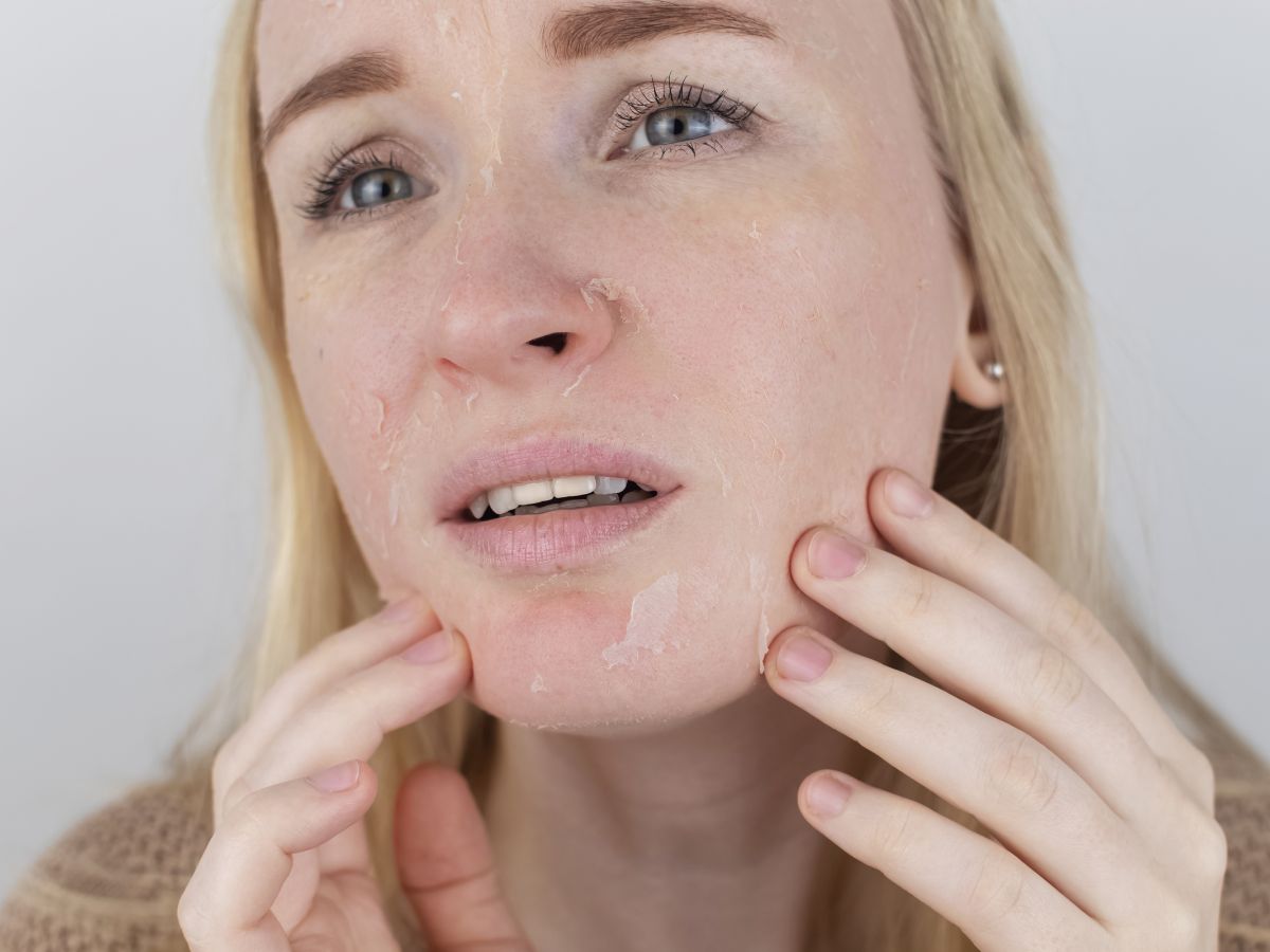 top-5-signs-you-are-over-exfoliating-your-skin-this-monsoon Top 5 Signs You Are Over-Exfoliating Your Skin This Monsoon - Photo Gallery