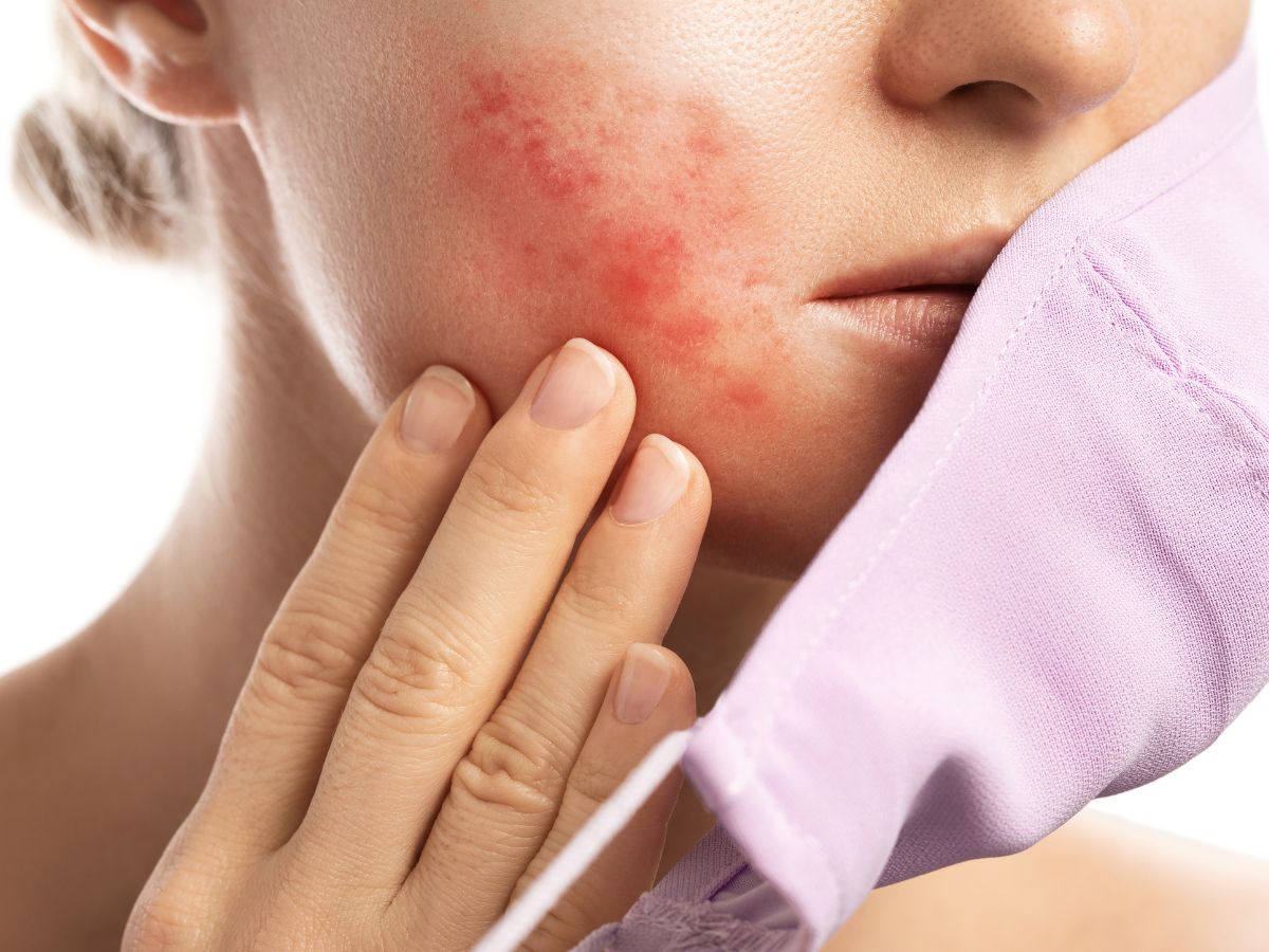 top-5-signs-you-are-over-exfoliating-your-skin-this-monsoon Top 5 Signs You Are Over-Exfoliating Your Skin This Monsoon - Photo Gallery