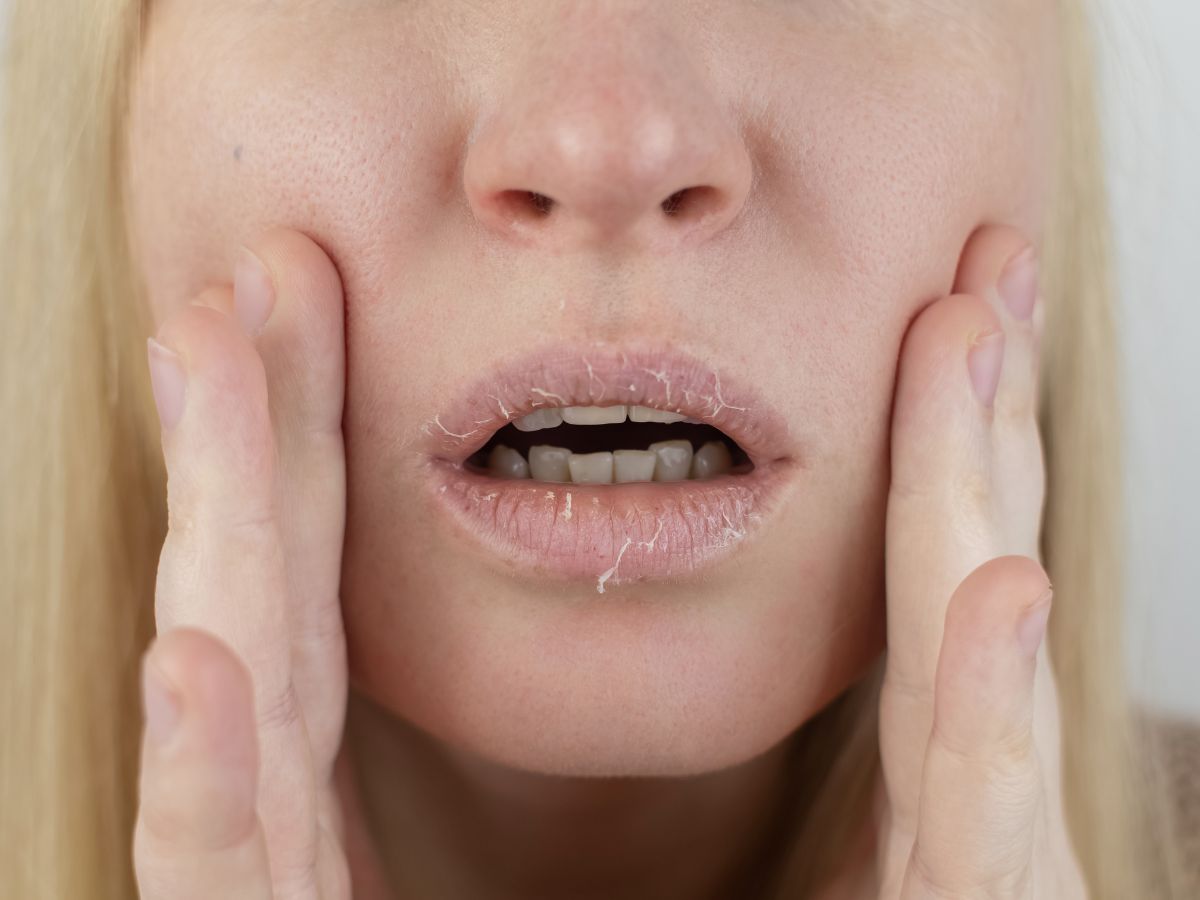 5 Skin Signs That Reveal Poor Gut Health - Photo Gallery
