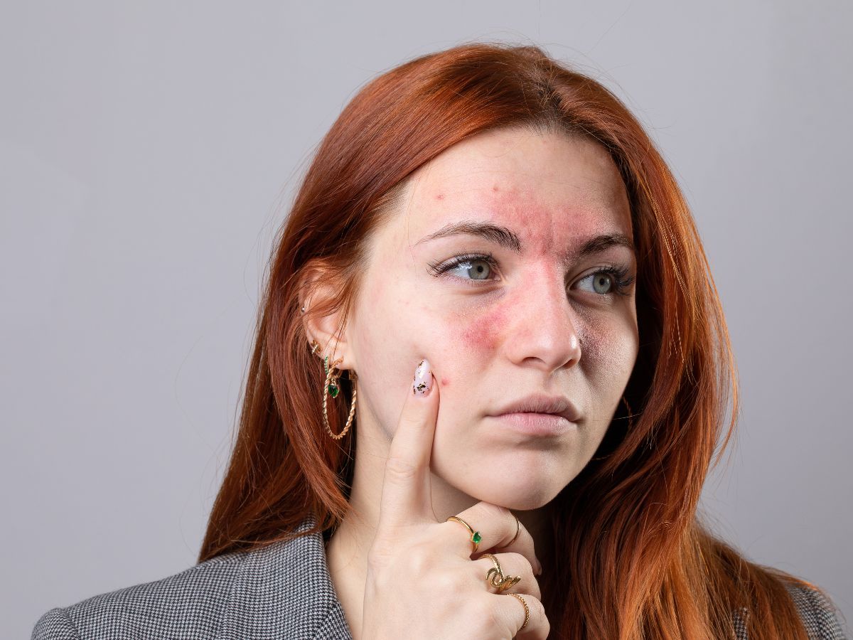 5 Skin Signs That Reveal Poor Gut Health - Photo Gallery