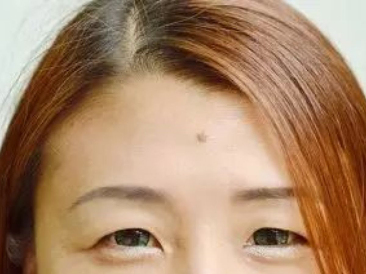 what-your-moles-say-about-you-exploring-the-hidden-meanings-of-beauty-marks-across-body What Your Moles Say About You? Exploring The Hidden Meanings Of Beauty Marks Across Body - Photo Gallery