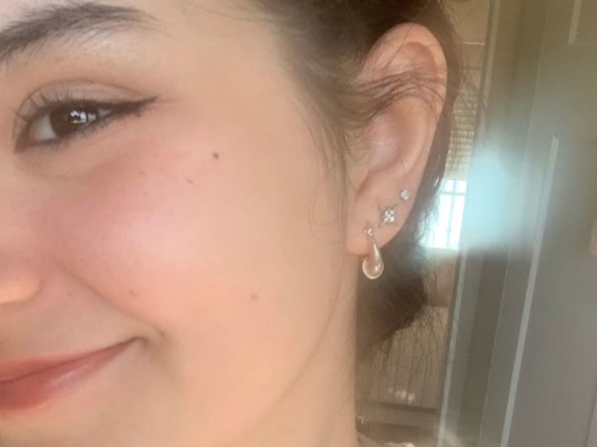 what-your-moles-say-about-you-exploring-the-hidden-meanings-of-beauty-marks-across-body What Your Moles Say About You? Exploring The Hidden Meanings Of Beauty Marks Across Body - Photo Gallery