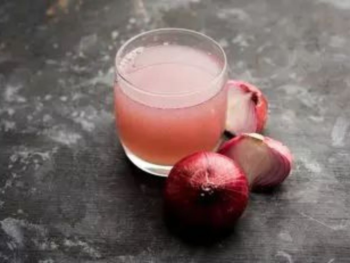 in-pics-hair-fall-worsening-in-monsoon-try-these-five-natural-remedies Onion juice is a powerful natural tonic for hair fall (Image Credit- Pinterest) - Photo Gallery