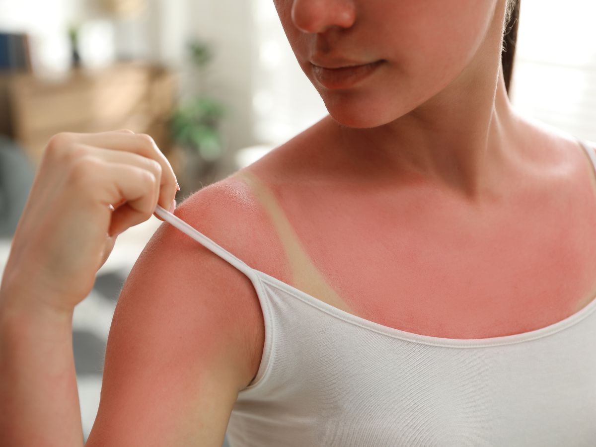 5 Easy Steps To Use Rice Flour And Milk To Remove Tanning - Photo Gallery