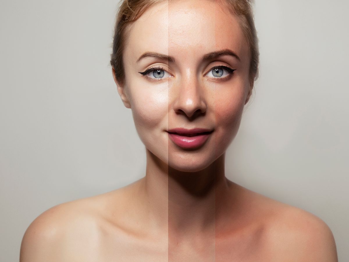 5 Easy Steps To Use Rice Flour And Milk To Remove Tanning - Photo Gallery