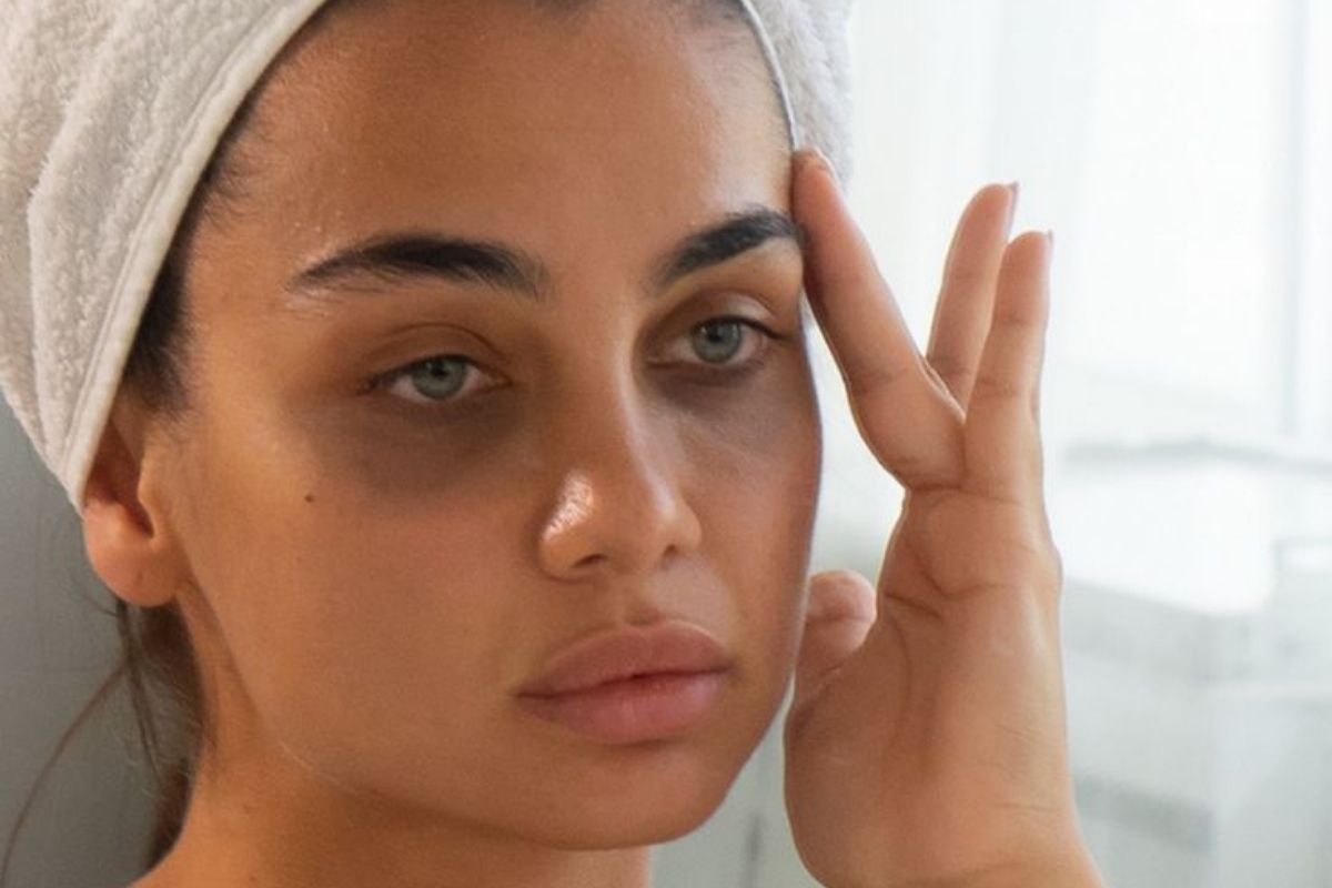 fatty-liver-clues-on-your-face-you-should-not-ignore-to-live-a-healthy-lifestyle Fatty Liver Clues On Your Face You Should Not Ignore - Photo Gallery