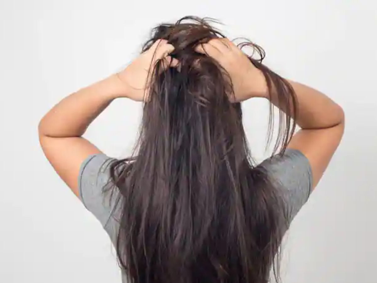 balding-thinning-hair-fitkari-might-be-the-secret-fix-you-need Balding? Thinning Hair? Fitkari Might Be the Secret Fix You Need! - Photo Gallery